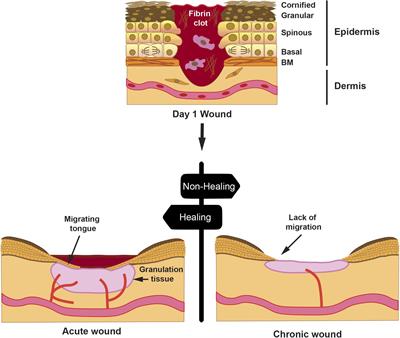 Chronic Wound Healing by Amniotic Membrane: TGF-β and EGF Signaling Modulation in Re-epithelialization